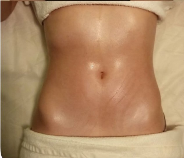 After — Waist definition result