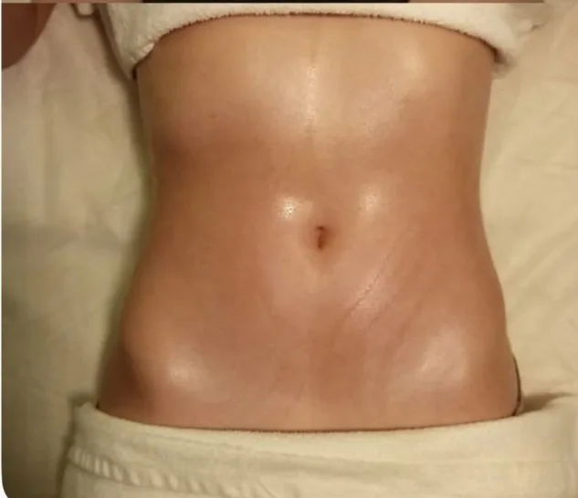 After — Waist definition result