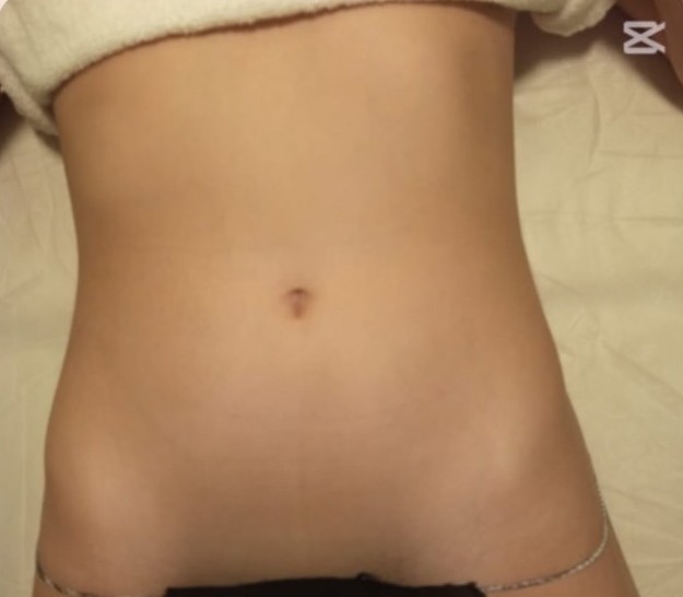 Before — Waist definition